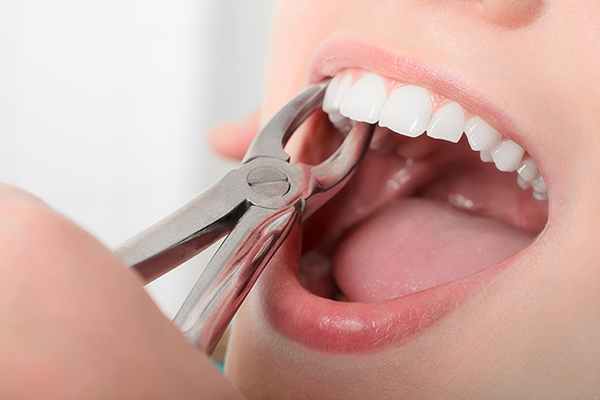 Показания и противопоказания после удаления зубов